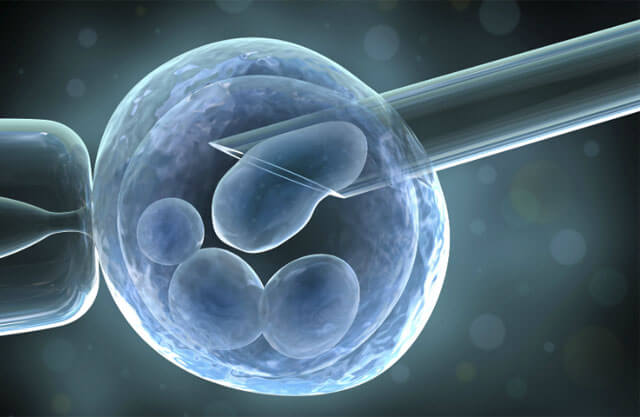 Thụ tinh nhân tạo (IVF) là phương pháp hiệu quả giúp phụ nữ mắc buồng trứng đa nang có thể mang thai