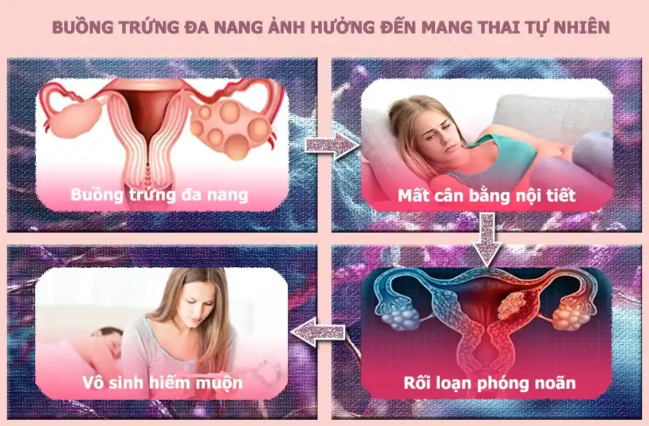 Buồng trứng đa nang ảnh hưởng đến khả năng mang thai tự nhiên và mang thai trong các phương pháp hỗ trợ sinh sản