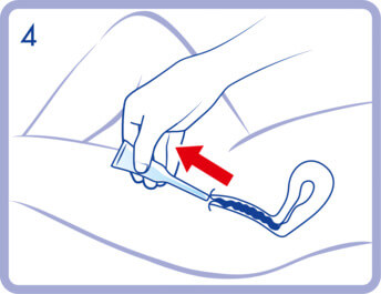 Sau đó kéo dụng cụ ra khỏi âm đạo trong khi vẫn giữ thân ống ép để không có dịch tiết âm đạo bị hút vào (4).