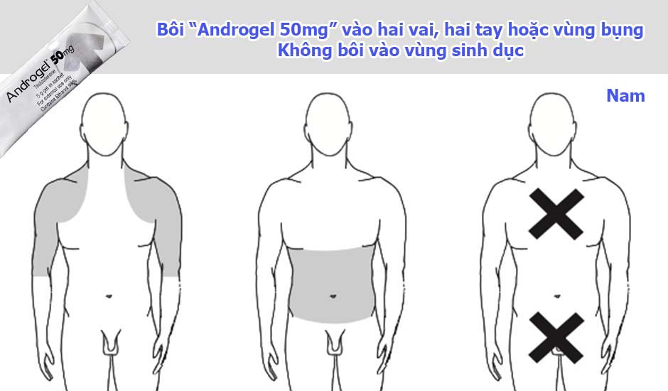 Đối với nam thì bôi Androgel 50mg vào các vùng được đánh được đánh dấu như hai vai, hai tay hoặc bụng. Không bôi thuốc vào vùng sinh dục được đánh dấu "X".