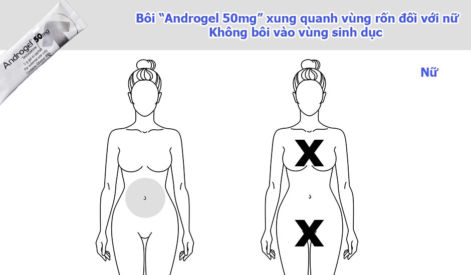 Đối với nữ dùng 1/4-1/3 gói Androgel 50mg bôi xung quanh vùng rốn, không bôi vào vùng sinh dục đánh dấu "X".