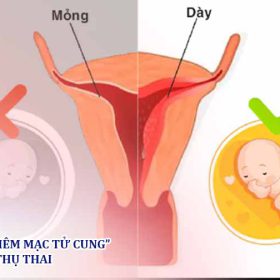 6 cách làm dày niêm mạc tử cung giúp dễ thụ thai